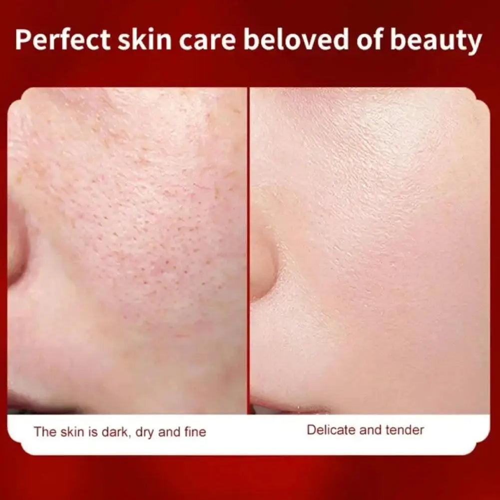 Retinol Dragon Blood Facial Cream Moisturize Repair Whiten Concealer Fine Lines Pores Acne Brighten Skin Tone Korean Cosmetics