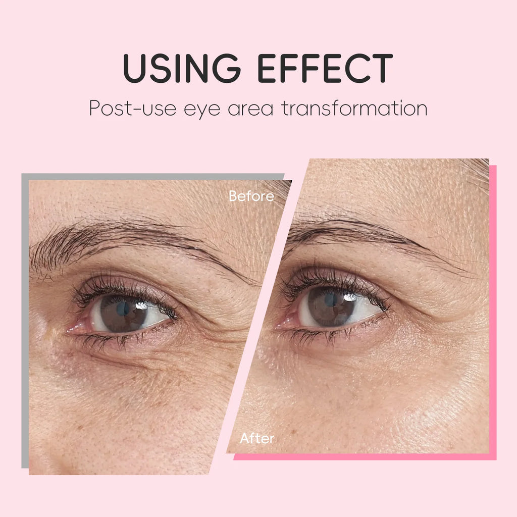 Contorno de Ojos LAIKOU Sakura con Rodillo — Antiojeras, Hidratante y Antiarrugas